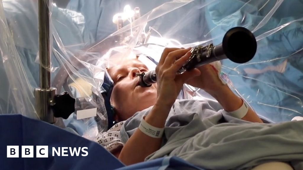 Woman plays clarinet during four-hour brain surgery