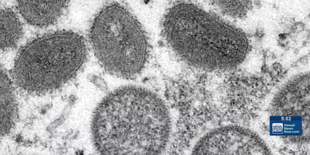 DOH detected Mpox in Oahu wastewater sample