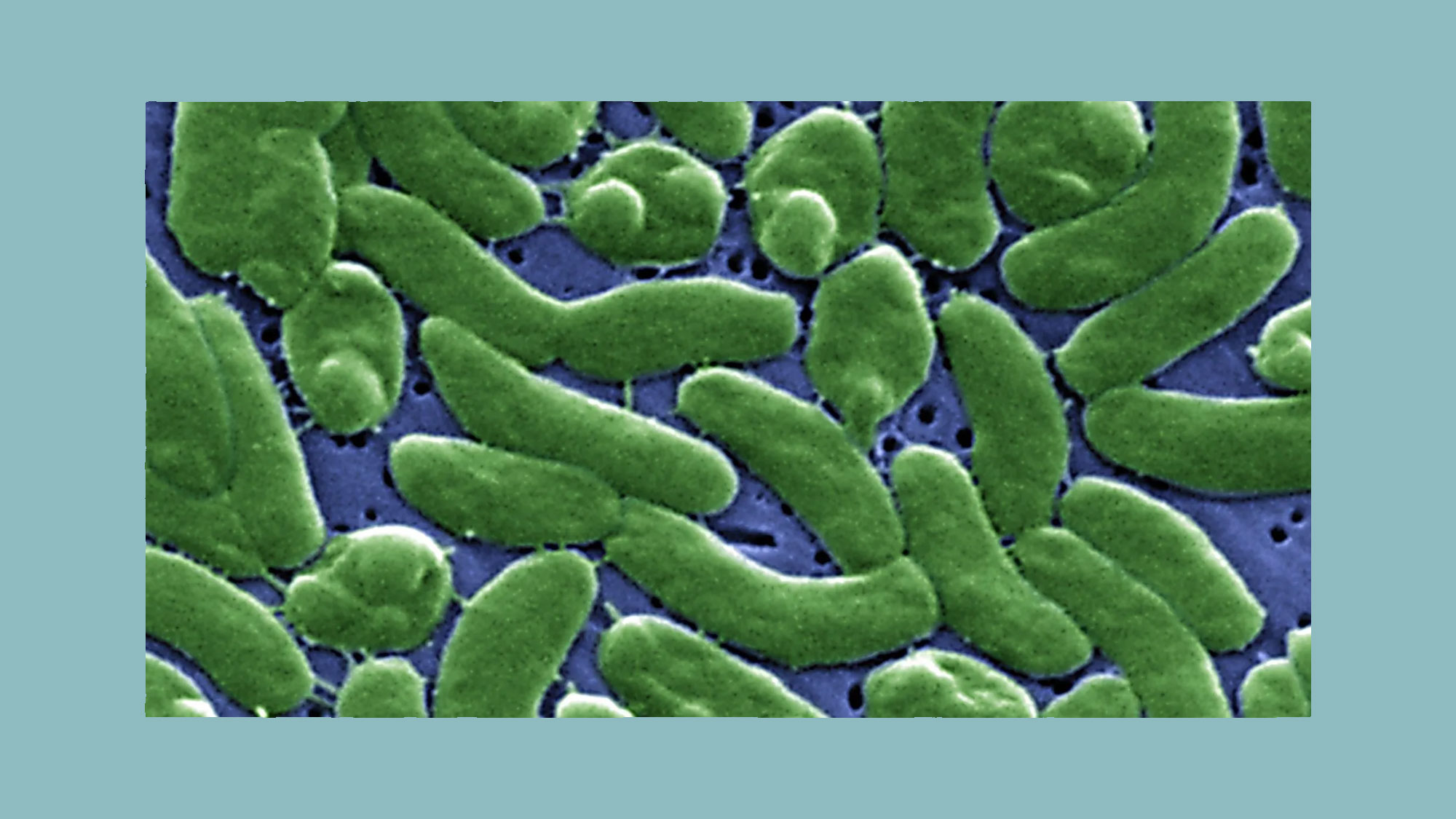 microscopic photo of the vibrio vulnificus bacteria