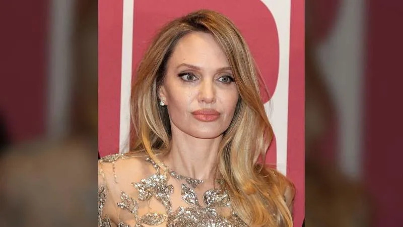Angelina Jolie has been the subject of plasic surgery speculation several times in 2026.MEGA
